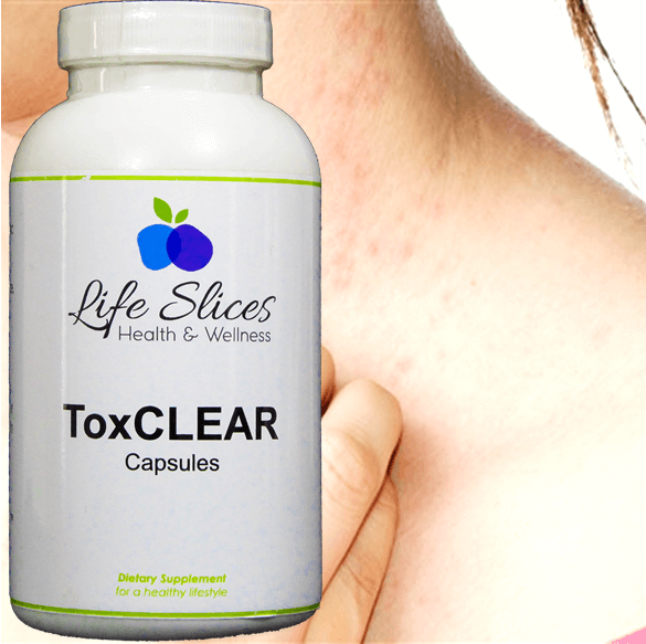 ToxCLEAR